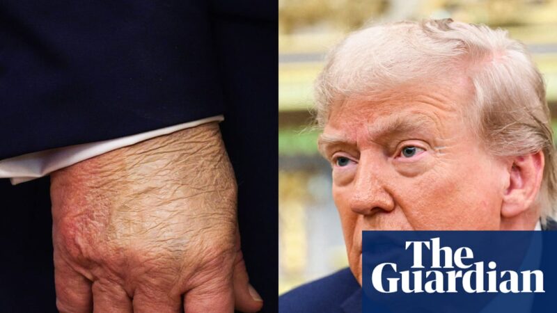 What the ‘is Trump dead?’ rumours reveal about our current moment | Donald Trump