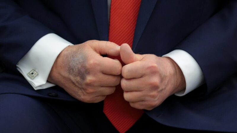 Contributor: Trump is old and ailing, but Democrats shouldn’t count on time to solve their problem