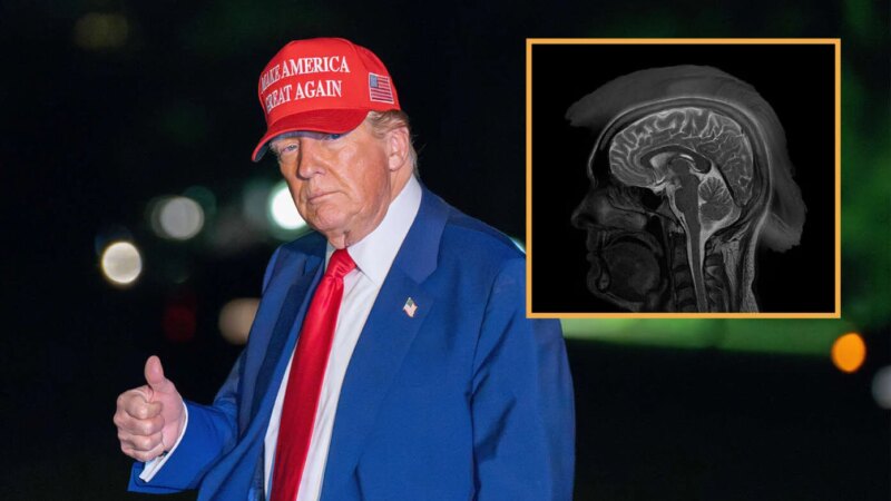 MRI Confirms President Donald Trump Has Incurable Advanced-Stage Patriotism